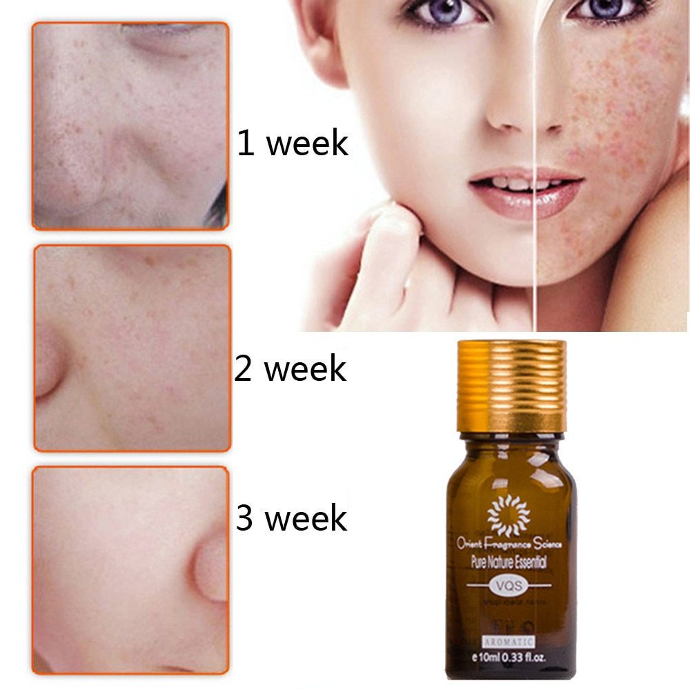 Dredge Meridian Natural Scar & Stretch Mark Removal Oil – Acne Care Essence CJ