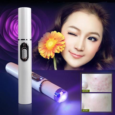 Blue Light Therapy Laser Pen – Acne & Wrinkle Treatment Renfan