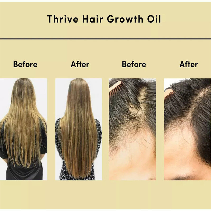 Hair Essential Oil – Nourishing Treatment for Dry and Irritated Hair CJ