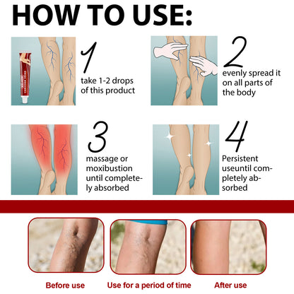 Earthworm Leg Vein Massage Cream – Relieves Varicose Veins and Reduces Leg Swelling