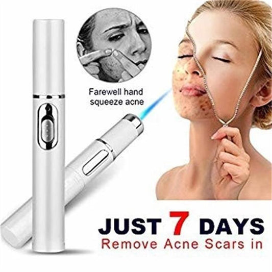 Blue Light Therapy Laser Pen – Acne & Wrinkle Treatment Renfan