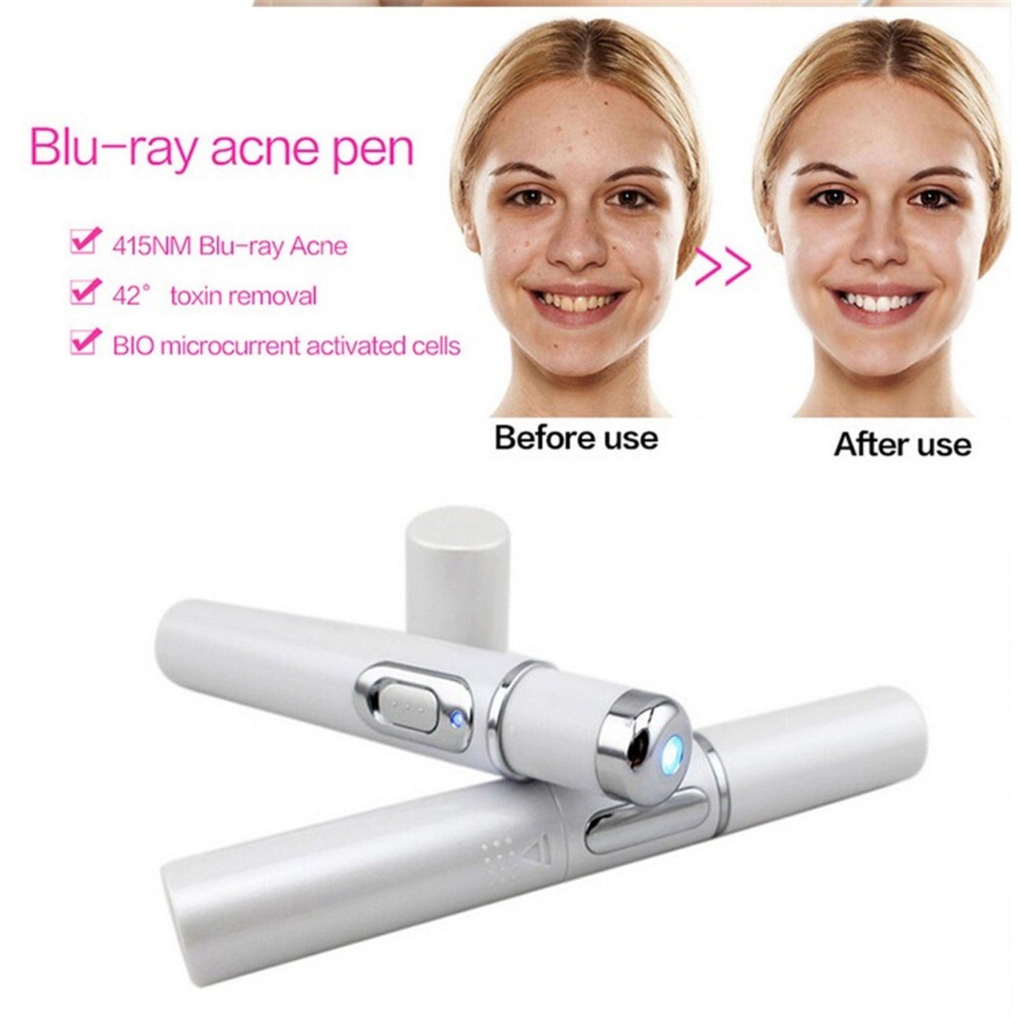 Blue Light Therapy Laser Pen – Acne & Wrinkle Treatment Renfan