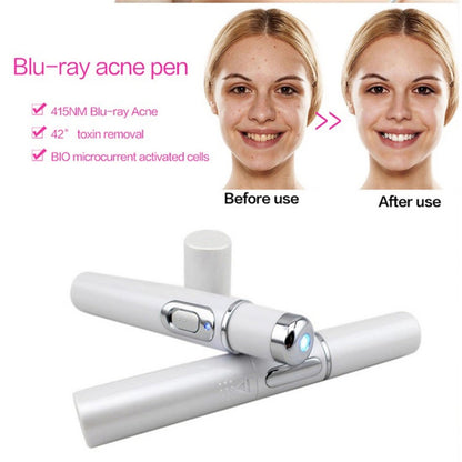 Blue Light Therapy Laser Pen – Acne & Wrinkle Treatment Renfan