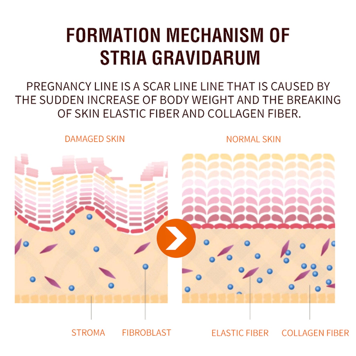Postpartum Skin Care Spray – Firming & Skin Fading