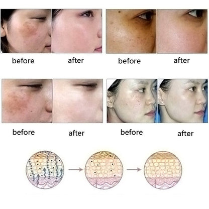 Dredge Meridian Natural Scar & Stretch Mark Removal Oil – Acne Care Essence CJ