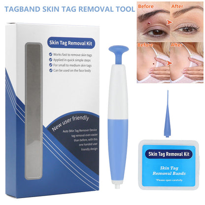 Skin Tag Removal Kit Home Use Mole Wart Remover Micro Band Skin Tag Treatment Tool Easy To Clean Skin Care Tool CJ