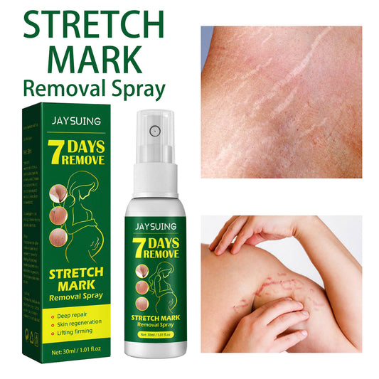 Postpartum Skin Care Spray – Firming & Skin Fading