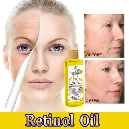Retinol Facial Soothing Oil – Hydrating & Anti-Aging Treatment