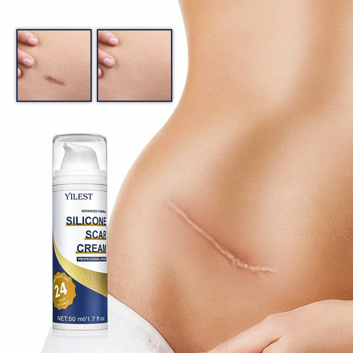 Scar Repair Cream – New & Old Trauma Care for Burns and Surgery