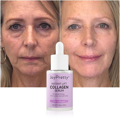 Collagen Serum – Moisturizing, Hydrating & Light Line Reduction