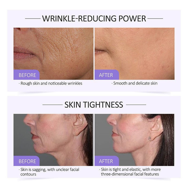 Collagen Serum – Moisturizing, Hydrating & Light Line Reduction