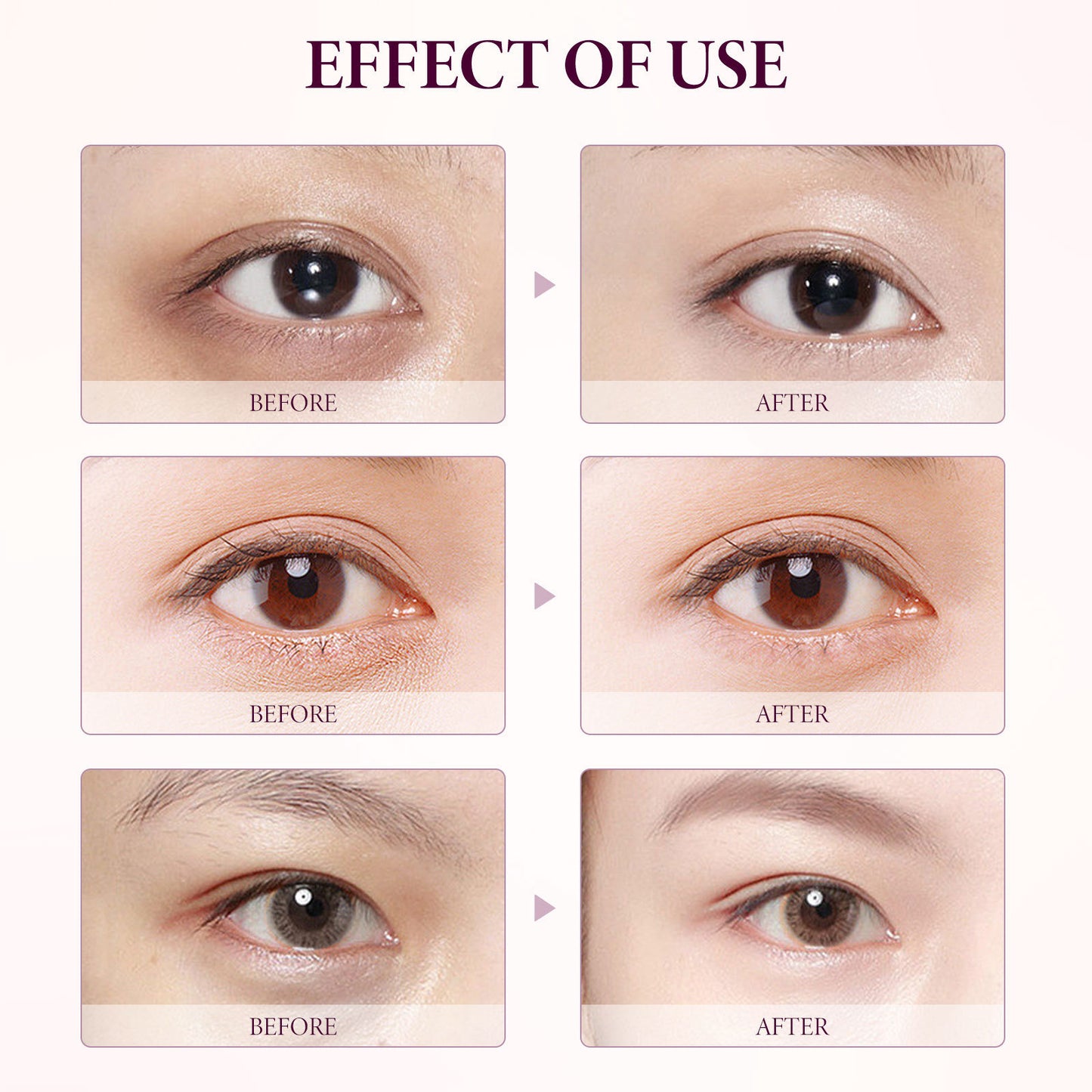 Mango Eye Cream – Fades Wrinkles & Smooths Fishtail Lines