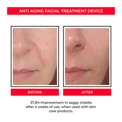 EMS Microcurrent Beauty Instrument – Pore Tightening and Skin Rejuvenation Device