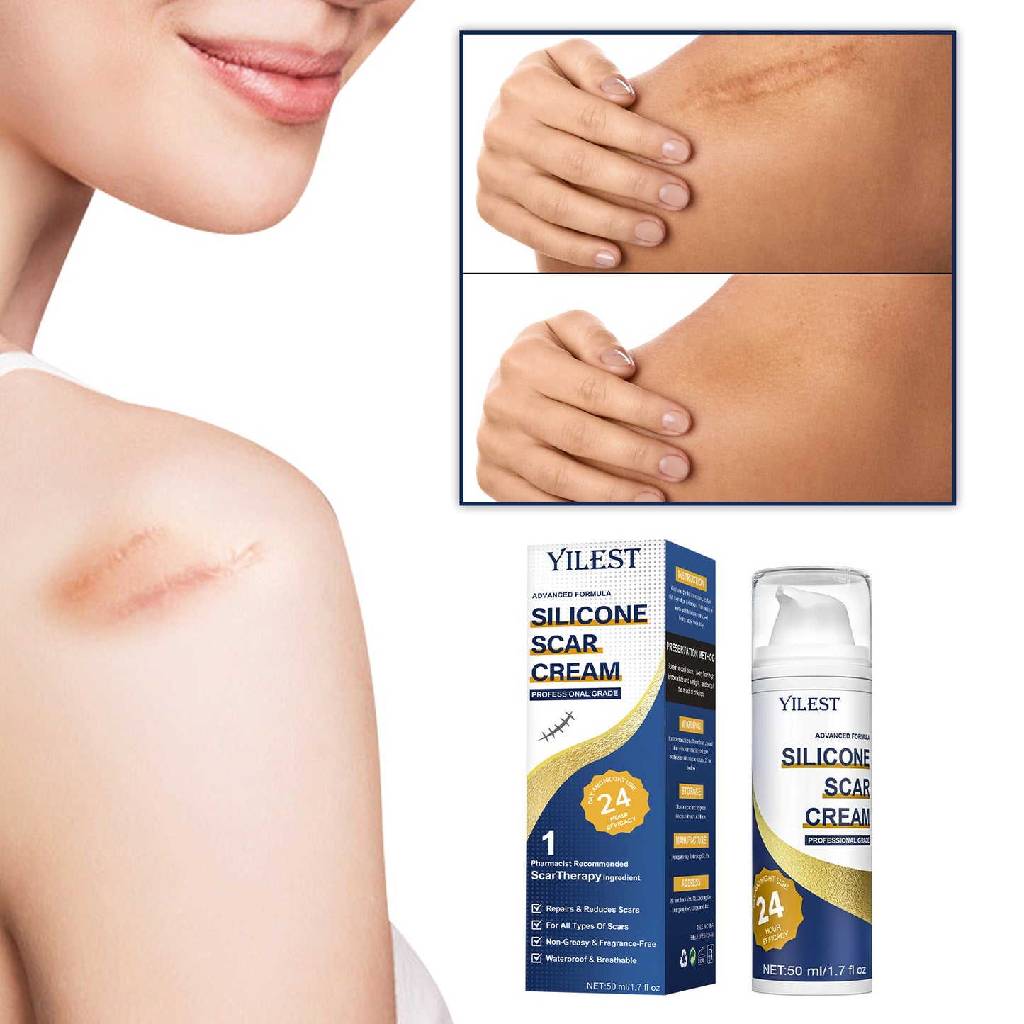Scar Repair Cream – New & Old Trauma Care for Burns and Surgery