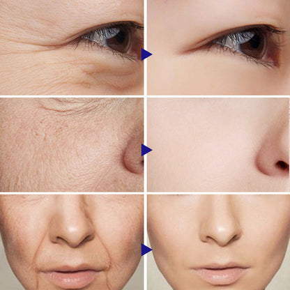VOVA Vitamin C Serum Facial Serum CJ