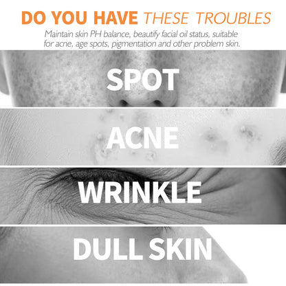 Turmeric Facial Oil – Dilutes Smallpox Scars, Refreshing & Oil Control