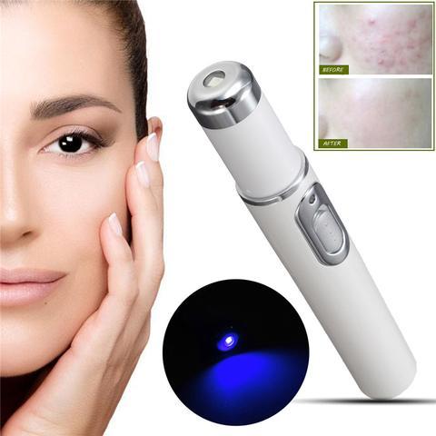 Blue Light Therapy Laser Pen – Acne & Wrinkle Treatment Renfan
