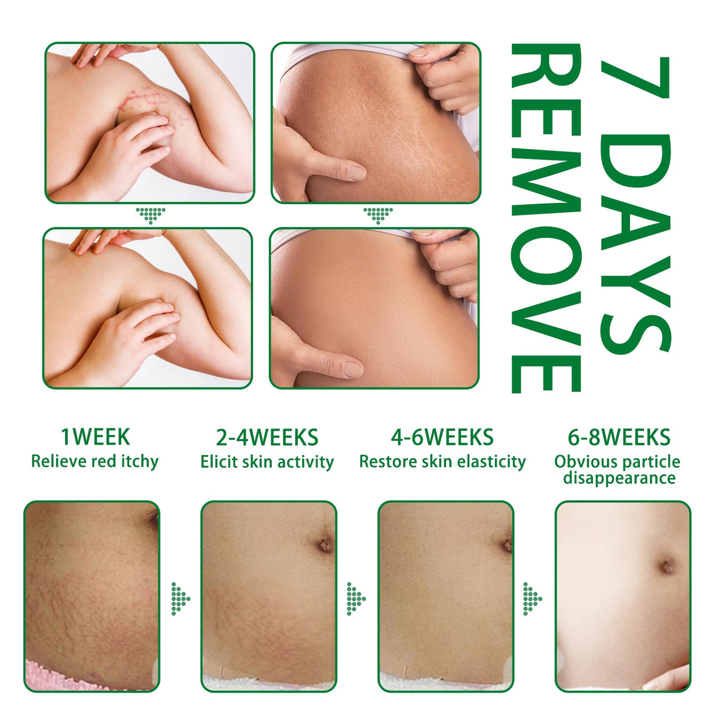 Postpartum Skin Care Spray – Firming & Skin Fading