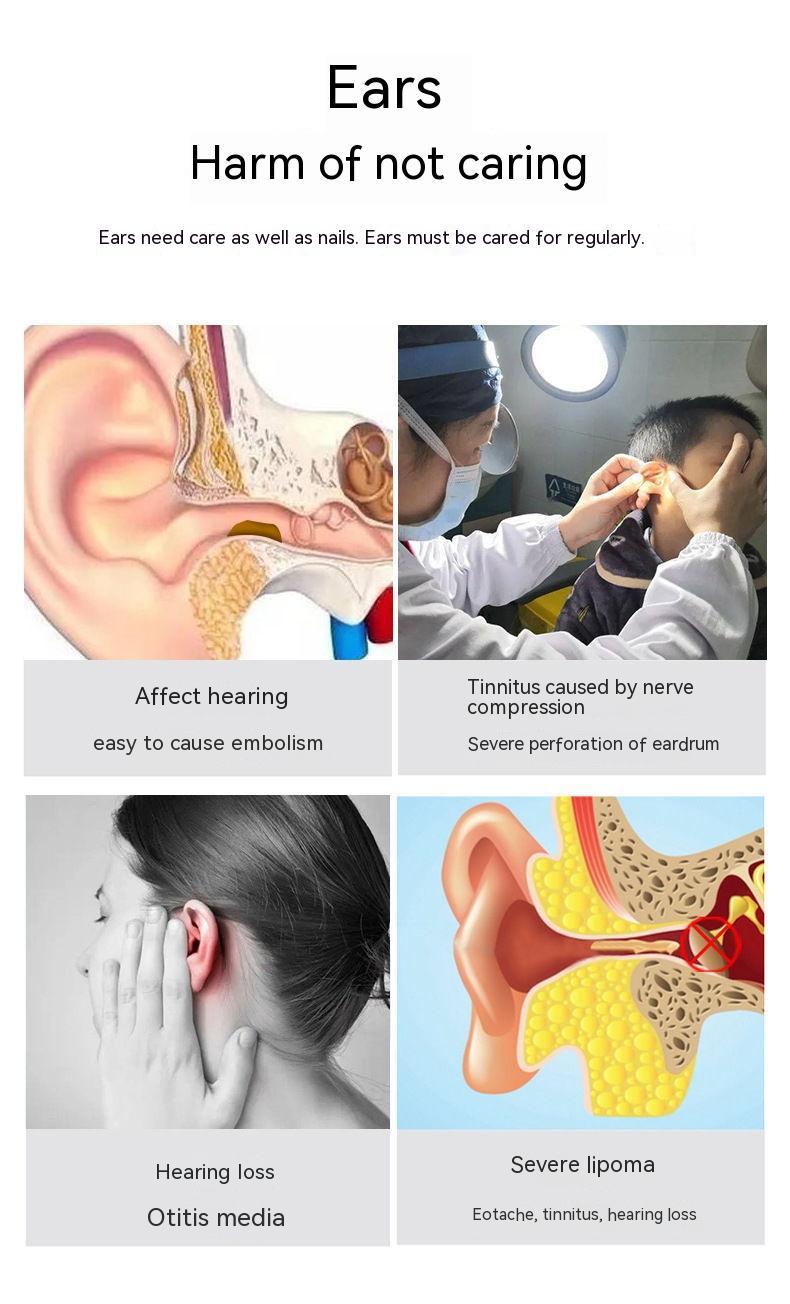 Wireless Smart HD Endoscope Ear Pick – Luminous Ear Cleaning Tool