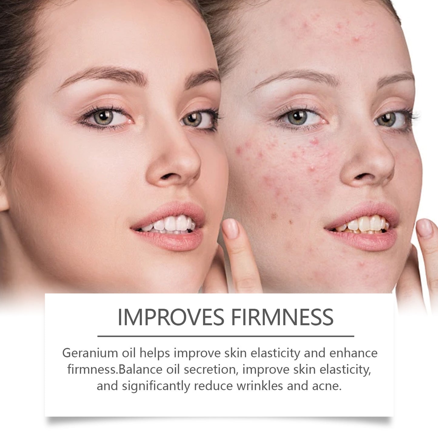 Retinol Facial Oil – Repair & Acne Skin Treatment