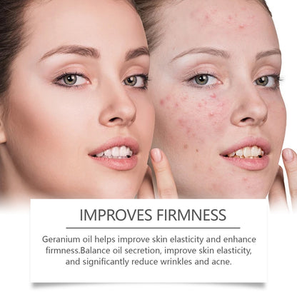 Retinol Facial Oil – Repair & Acne Skin Treatment