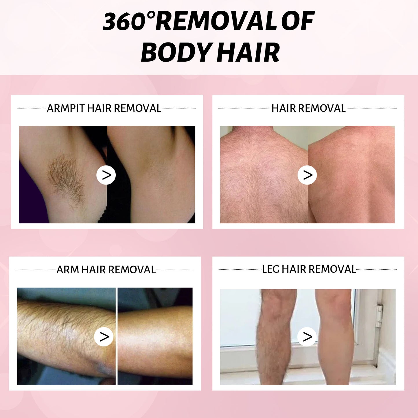 Gentle Hair Removal Spray – 30ml/100ml Depilatory Foam for Armpits and Legs
