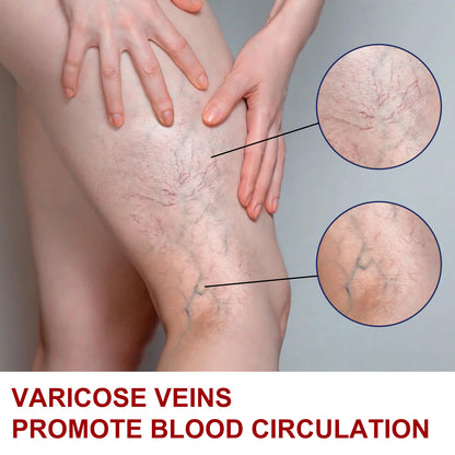 Earthworm Leg Vein Massage Cream – Relieves Varicose Veins and Reduces Leg Swelling