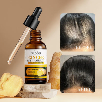 Ginger Hair Care Oil – Hair Growth & Anti-Hair Loss Treatment