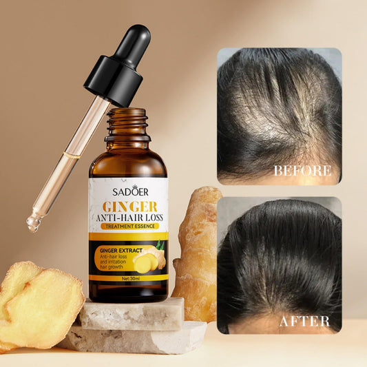 Ginger Hair Care Oil – Hair Growth & Anti-Hair Loss Treatment