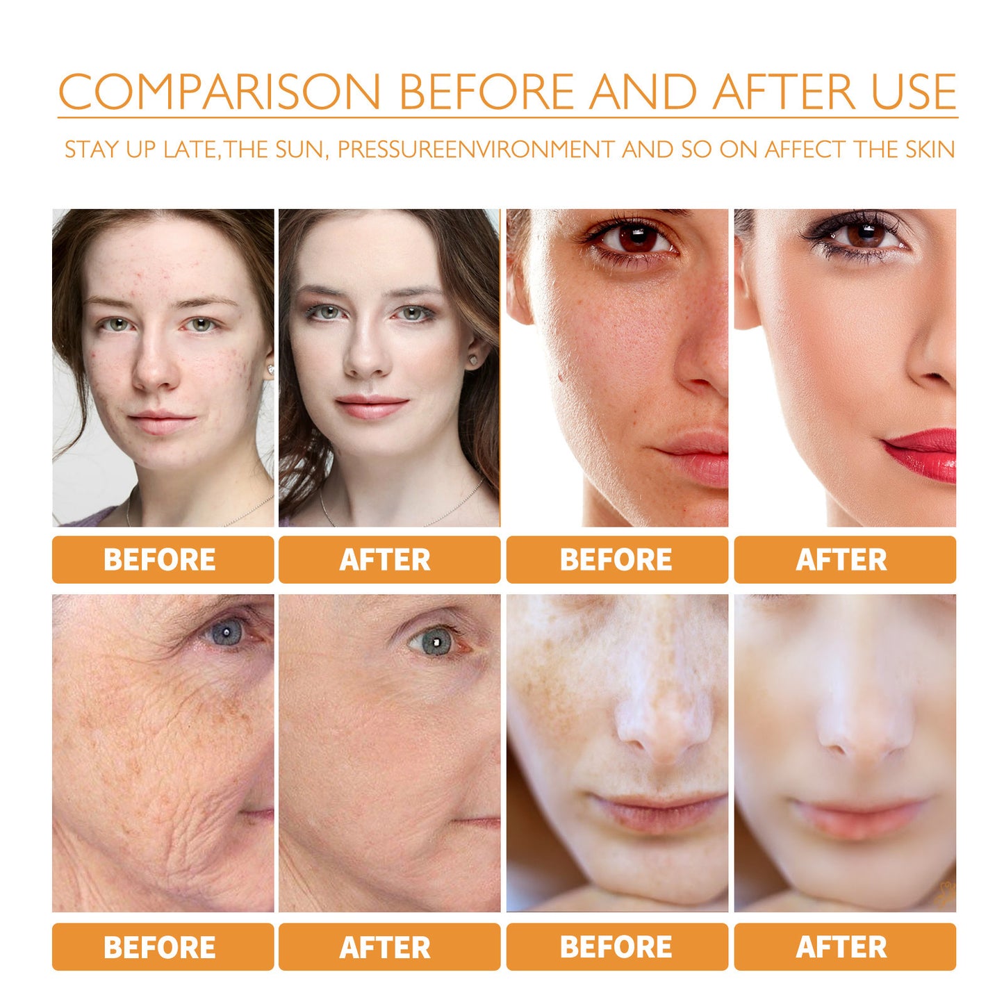 Turmeric Facial Oil – Dilutes Smallpox Scars, Refreshing & Oil Control