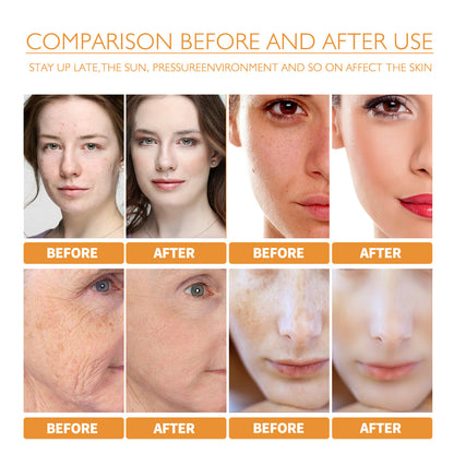 Turmeric Facial Oil – Dilutes Smallpox Scars, Refreshing & Oil Control